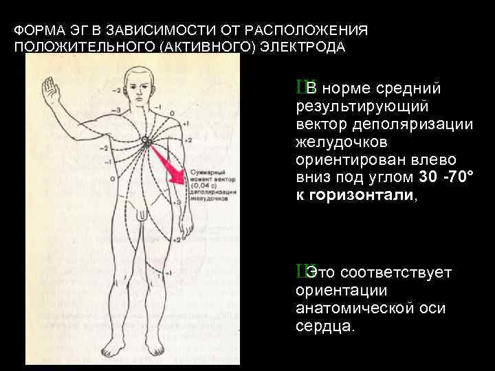 Зачем нужно экг. Что такое активный электрод в ЭКГ. Зачем нужен ЭКГ. Активный электрод во II стандартном отведении находится на. Как правильно записывать ЭКГ.