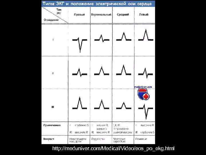 http: //meduniver. com/Medical/Video/eos_po_ekg. html 