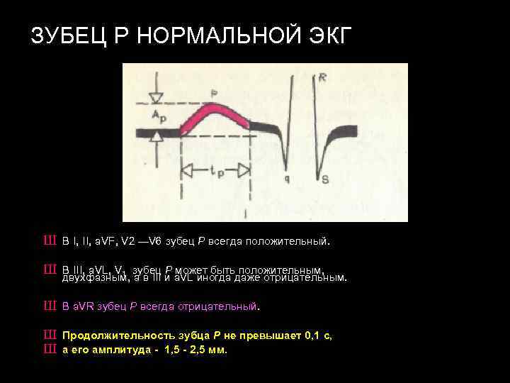 Р на экг. Зубец р на ЭКГ отрицательный в норме. В нормальной ЭКГ зубец р в v1. Двухфазный зубец r на ЭКГ. Зубец p на ЭКГ отражает.