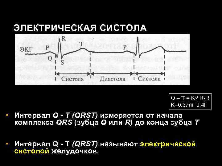 ЭЛЕКТРИЧЕСКАЯ СИСТОЛА Q – T = K√ R-R K=0, 37 m 0, 4 f