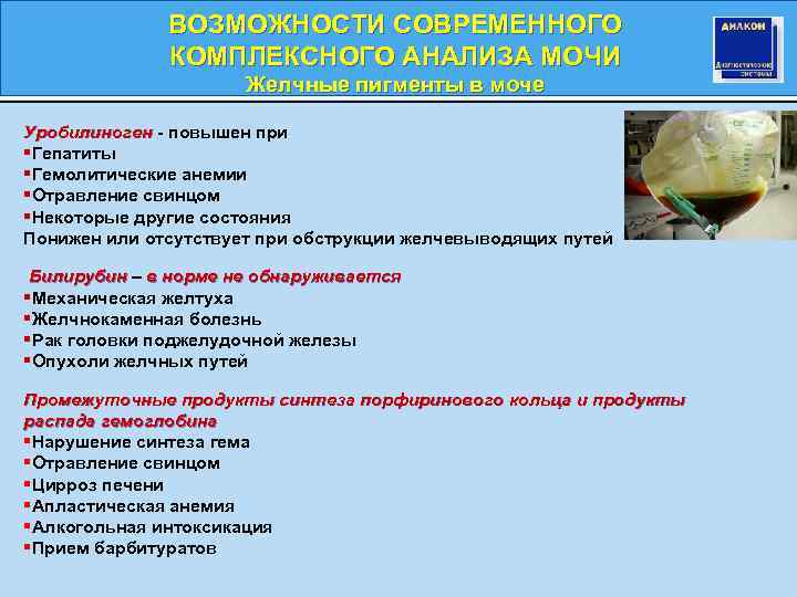 ВОЗМОЖНОСТИ СОВРЕМЕННОГО КОМПЛЕКСНОГО АНАЛИЗА МОЧИ Желчные пигменты в моче Уробилиноген - повышен при §Гепатиты