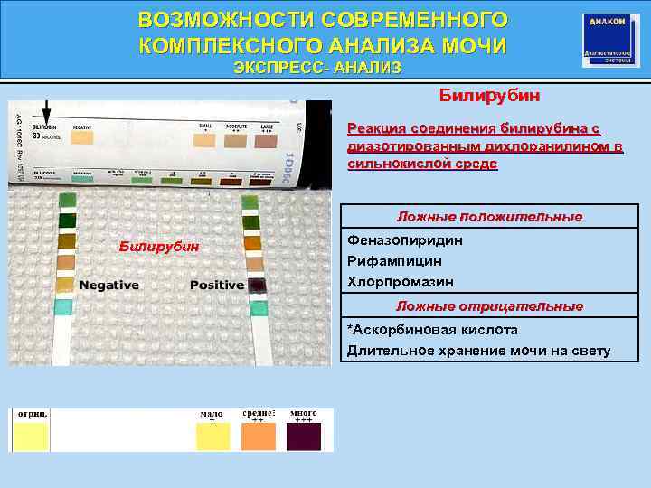 ВОЗМОЖНОСТИ СОВРЕМЕННОГО КОМПЛЕКСНОГО АНАЛИЗА МОЧИ ЭКСПРЕСС- АНАЛИЗ Билирубин Реакция соединения билирубина с диазотированным дихлоранилином