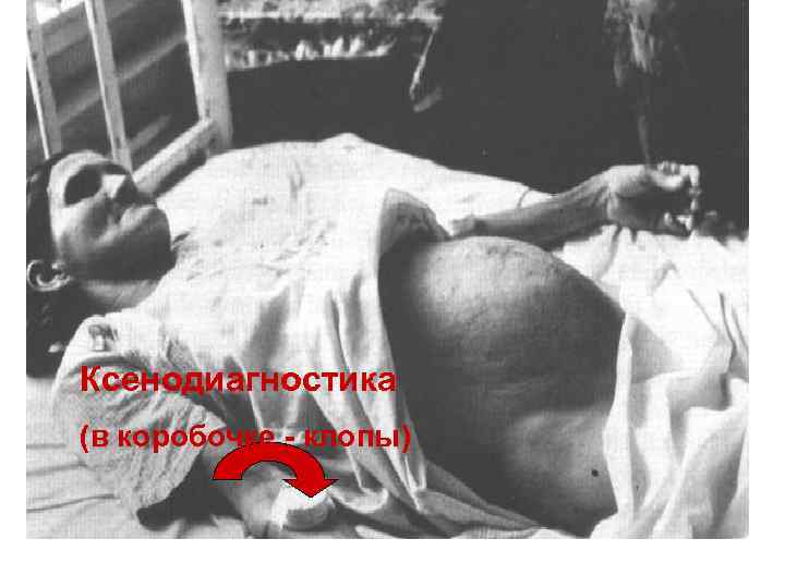 Ксенодиагностика (в коробочке - клопы) 