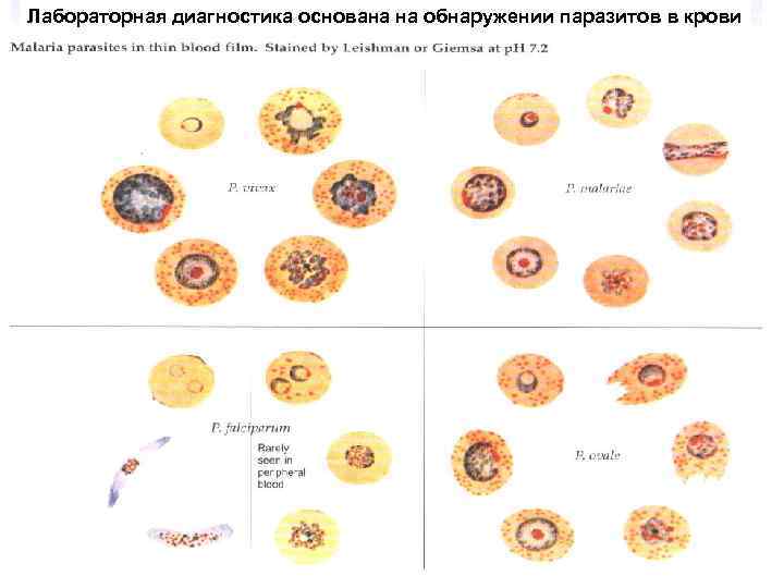 Лабораторная диагностика основана на обнаружении паразитов в крови 