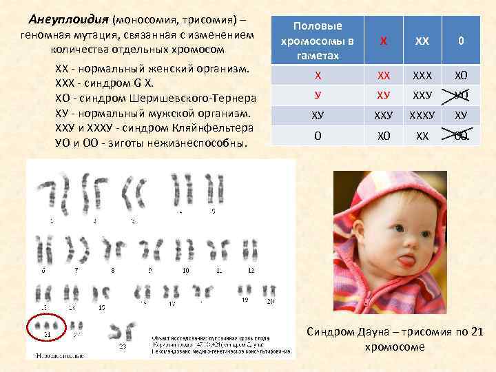 Анеуплоидия по аутосомам