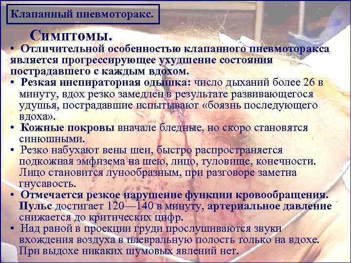 Клапанный пневмоторакс. Симптомы. • Отличительной особенностью клапанного пневмоторакса является прогрессирующее ухудшение состояния пострадавшего с