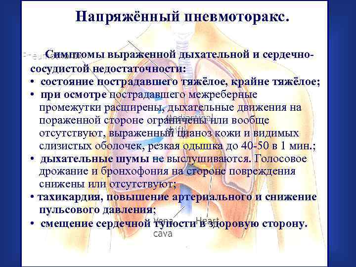 Напряжённый пневмоторакс. Симптомы выраженной дыхательной и сердечнососудистой недостаточности: • состояние пострадавшего тяжёлое, крайне тяжёлое;