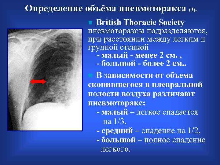 Травматический пневмоторакс карта вызова смп