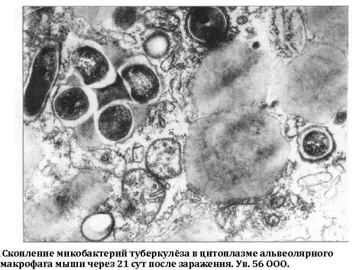 Туберкулез Кур Фото