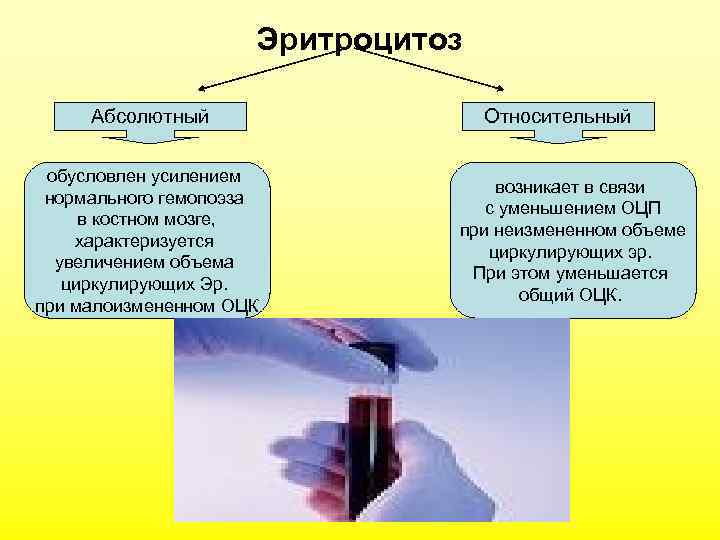 Эритроцитоз Абсолютный обусловлен усилением нормального гемопоэза в костном мозге, характеризуется увеличением объема циркулирующих Эр.