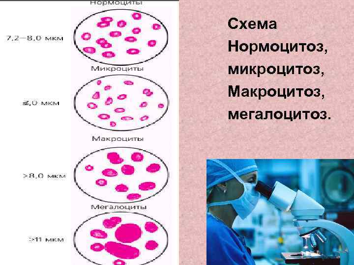 Макроцитоз