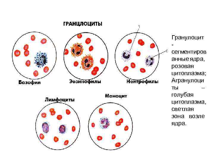 Гранулоцит - сегментиров анные ядра, розовая цитоплазма; Агранулоци ты – голубая цитоплазма, светлая зона