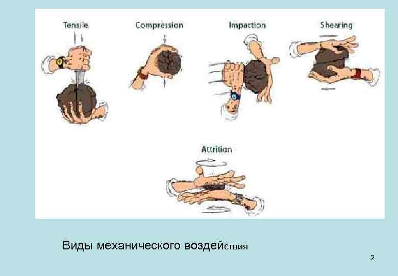 Виды механического воздействия 2 