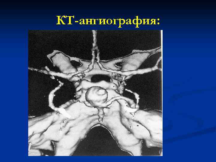 КТ-ангиография: 