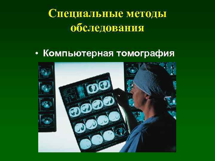 Специальные методы обследования • Компьютерная томография 