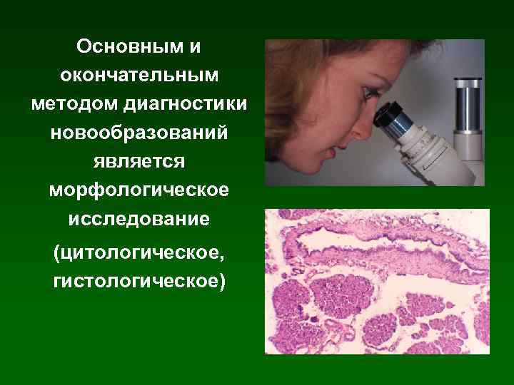 Основным и окончательным методом диагностики новообразований является морфологическое исследование (цитологическое, гистологическое) 