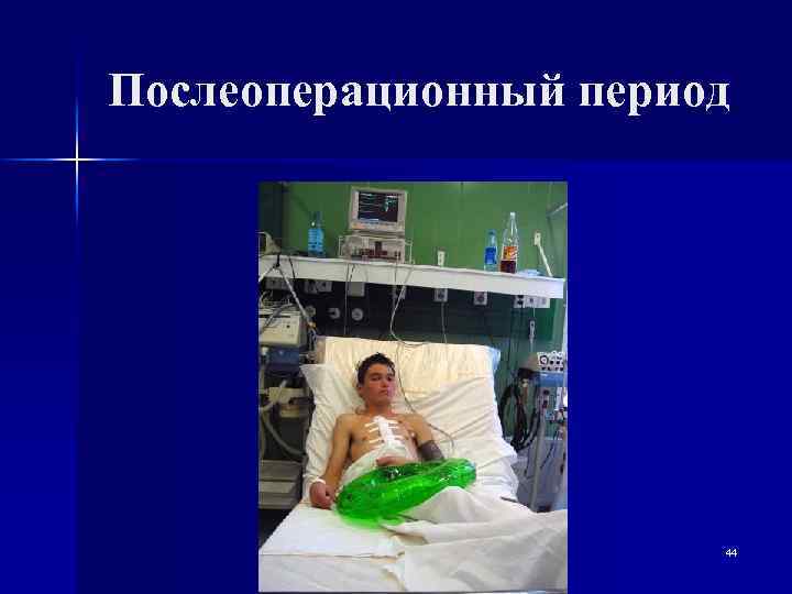 Послеоперационный период 44 