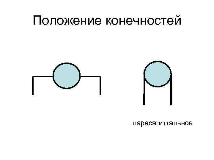 Положение конечностей парасагиттальное 