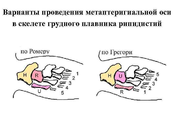 Варианты проведения метаптеригиальной оси в скелете грудного плавника рипидистий 