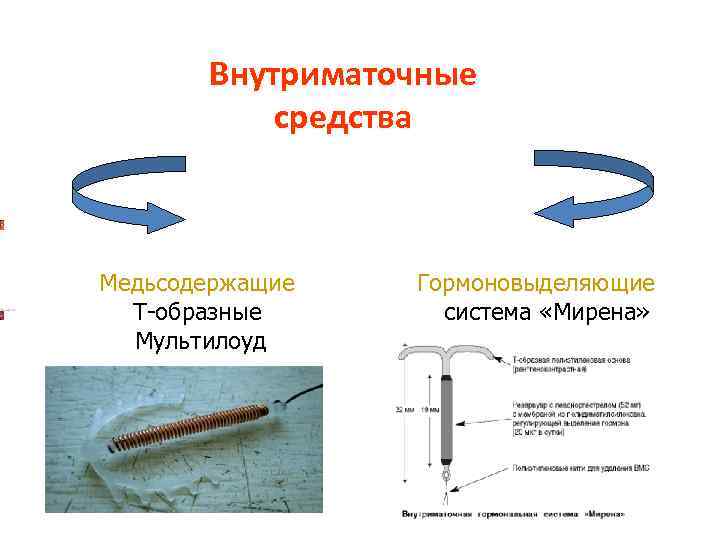 Внутриматочные средства Медьсодержащие Т-образные Мультилоуд Гормоновыделяющие система «Мирена» 