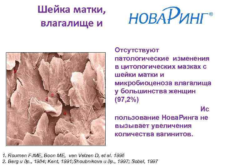 Шейка матки, влагалище и Отсутствуют патологические изменения в цитологических мазках с шейки матки и