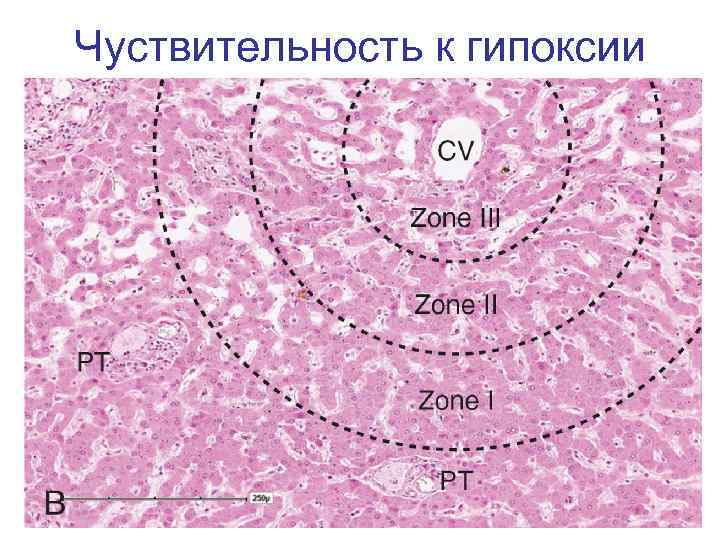 Чуствительность к гипоксии 