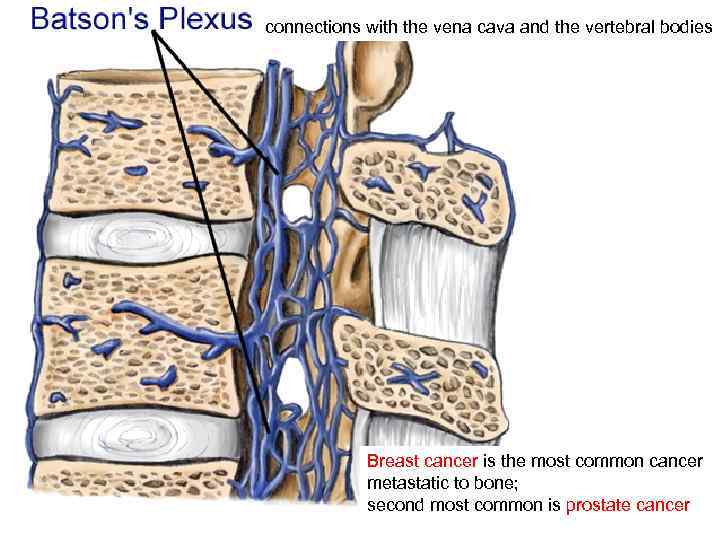 connections with the vena cava and the vertebral bodies Breast cancer is the most