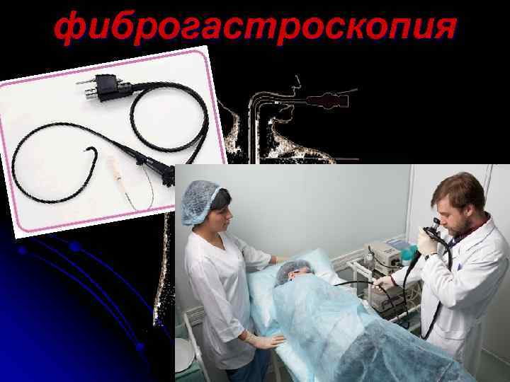 фиброгастроскопия 