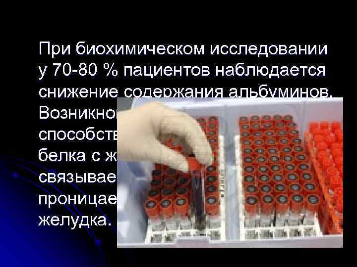 При биохимическом исследовании у 70 -80 % пациентов наблюдается снижение содержания альбуминов. Возникновению гипоальбуминемии