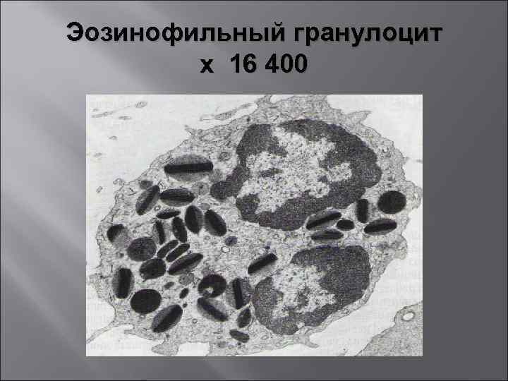 Эозинофильный гранулоцит х 16 400 