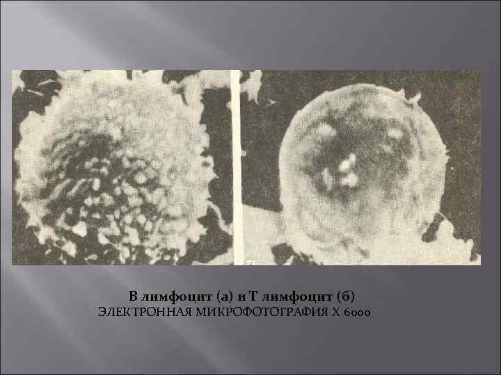 В лимфоцит (а) и Т лимфоцит (б) ЭЛЕКТРОННАЯ МИКРОФОТОГРАФИЯ X 6000 