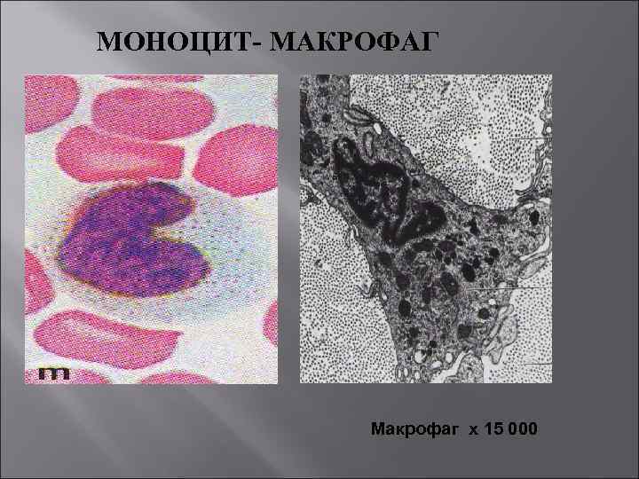 МОНОЦИТ- МАКРОФАГ Макрофаг х 15 000 