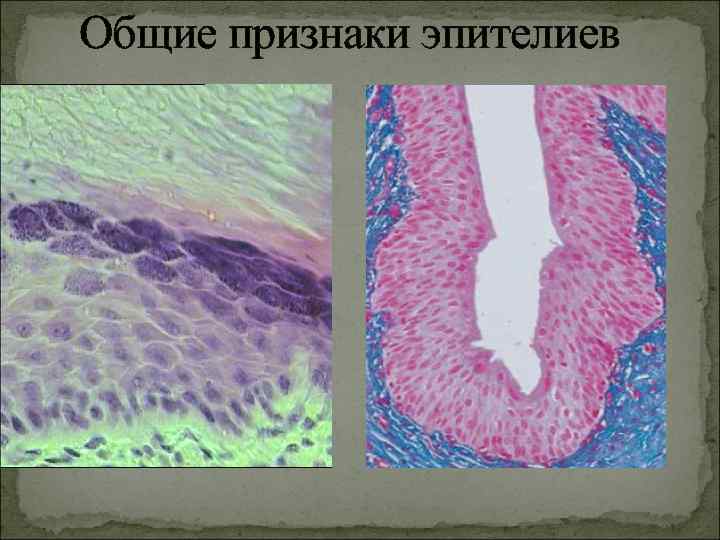 Общие признаки эпителиев 