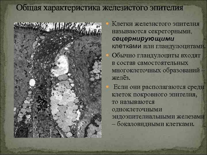  Общая характеристика железистого эпителия Клетки железистого эпителия называются секреторными, сецернирующими клетками или гландулоцитами.