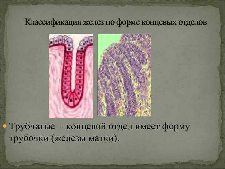 Классификация желез по форме концевых отделов Трубчатые - концевой отдел имеет форму трубочки (железы
