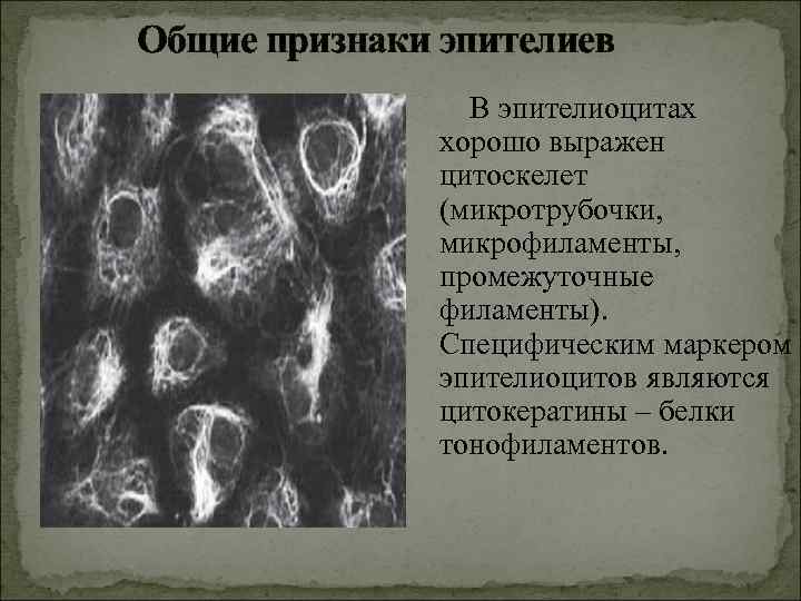Общие признаки эпителиев В эпителиоцитах хорошо выражен цитоскелет (микротрубочки, микрофиламенты, промежуточные филаменты). Специфическим маркером