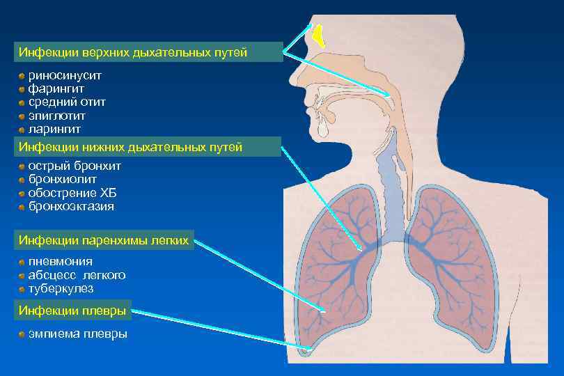 Тест заболевания верхних дыхательных путей