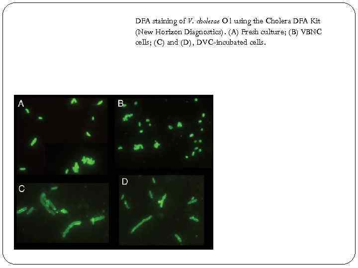 DFA staining of V. cholerae O 1 using the Cholera DFA Kit (New Horizon