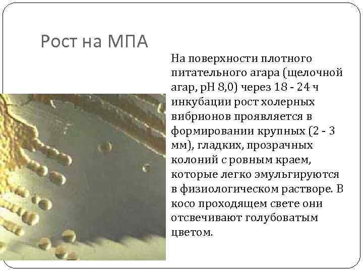 Рост на МПА На поверхности плотного питательного агара (щелочной агар, p. H 8, 0)