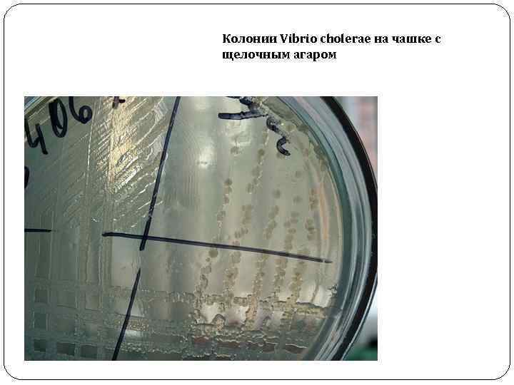 Колонии Vibrio cholerae на чашке с щелочным агаром 