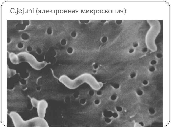C. jejuni (электронная микроскопия) 