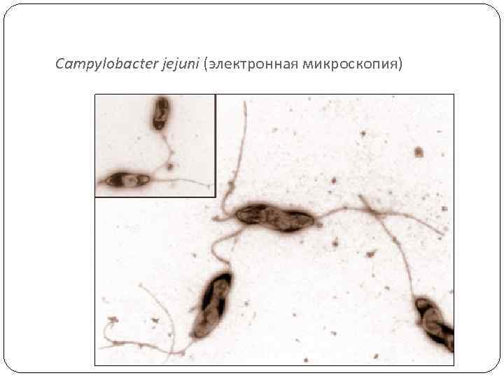 Campylobacter jejuni (электронная микроскопия) 