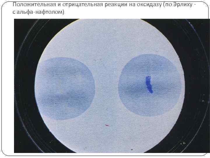 Положительная и отрицательная реакции на оксидазу (по Эрлиху с альфа-нафтолом) 