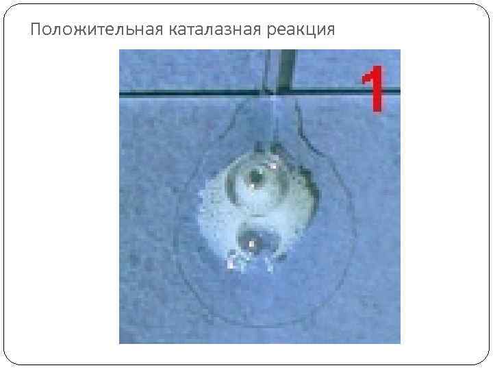 Положительная каталазная реакция 