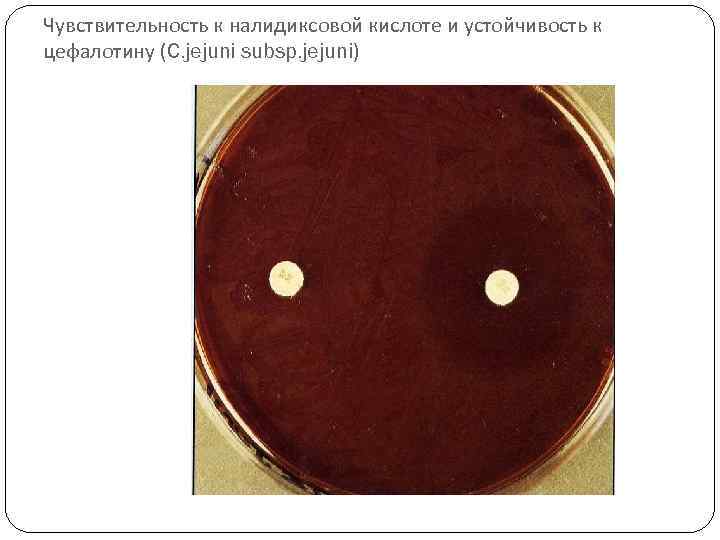 Чувствительность к налидиксовой кислоте и устойчивость к цефалотину (C. jejuni subsp. jejuni) 