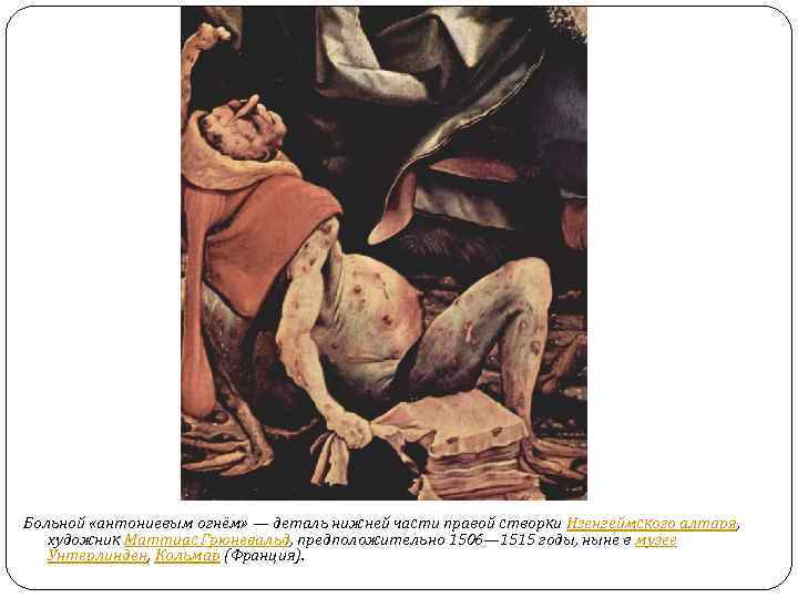 Больной «антониевым огнём» — деталь нижней части правой створки Изенгеймского алтаря, художник Маттиас Грюневальд,