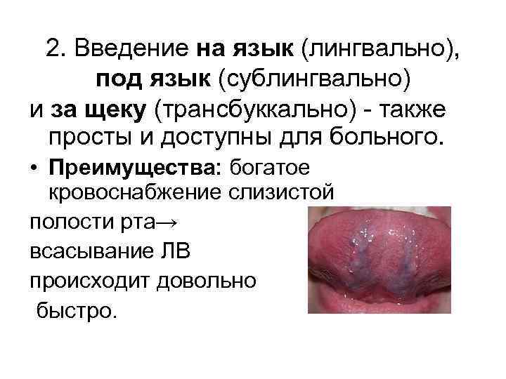 2. Введение на язык (лингвально), под язык (сублингвально) и за щеку (трансбуккально) - также