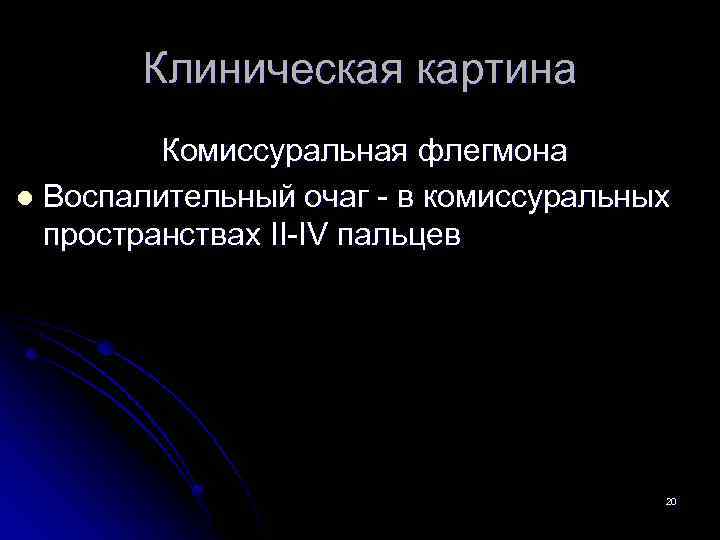 Клиническая картина Комиссуральная флегмона l Воспалительный очаг - в комиссуральных пространствах II-IV пальцев 20
