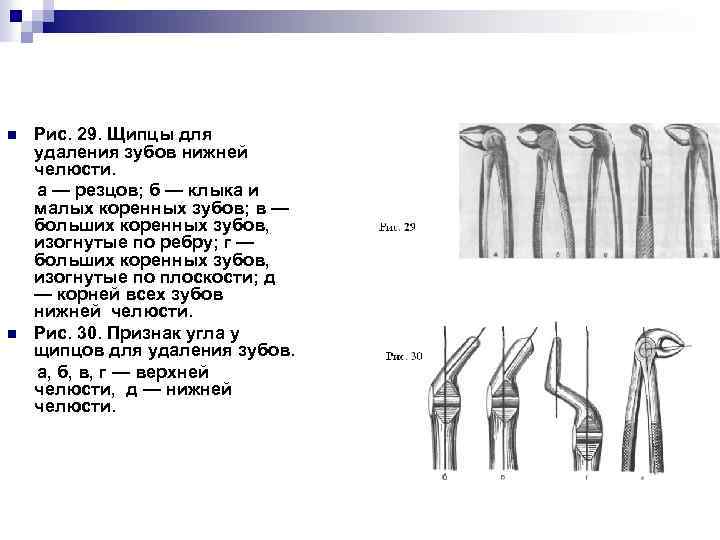 n n Рис. 29. Щипцы для удаления зубов нижней челюсти. а — резцов; б