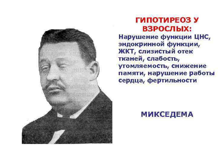 ГИПОТИРЕОЗ У ВЗРОСЛЫХ: Нарушение функции ЦНС, эндокринной функции, ЖКТ, слизистый отек тканей, слабость, утомляемость,